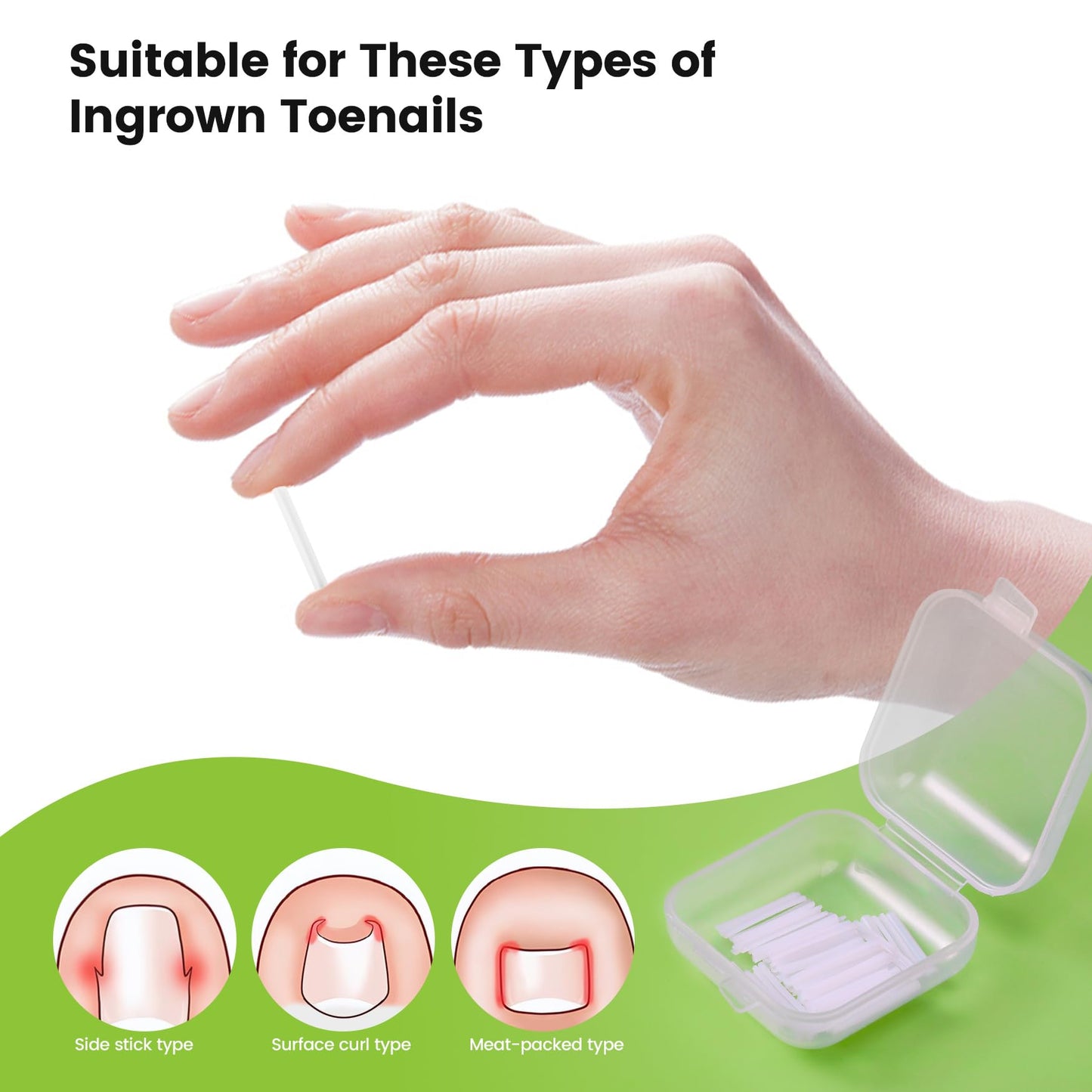 BEZOX Ingrown Toenail Corrector Set - 40 Pcs Pain-Free Toenail Straightener Strips with Toenail Lifter - Easy Use Ingrown Toenail Tools Kit