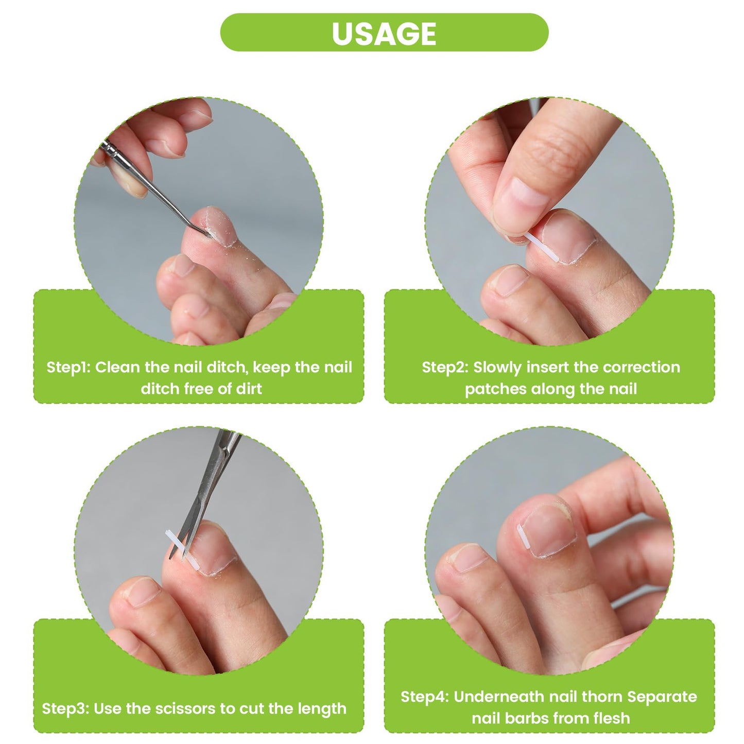 BEZOX Ingrown Toenail Corrector Set - 40 Pcs Pain-Free Toenail Straightener Strips with Toenail Lifter - Easy Use Ingrown Toenail Tools Kit