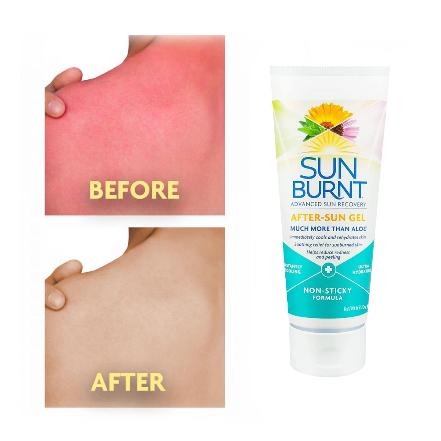 EMCW9 Ultra Hydrating Aloe Vera Gel by Sunburnt 6 Ounce,Clear,SUNB21006