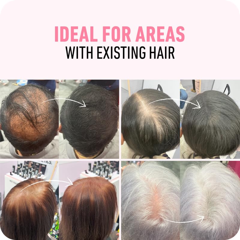 BOLDIFY Hair Fibers (12g) - Fill In Thinning and Fine Hair for an Instantly Fuller, Thicker Look - 14 Shades for Women & Men - White