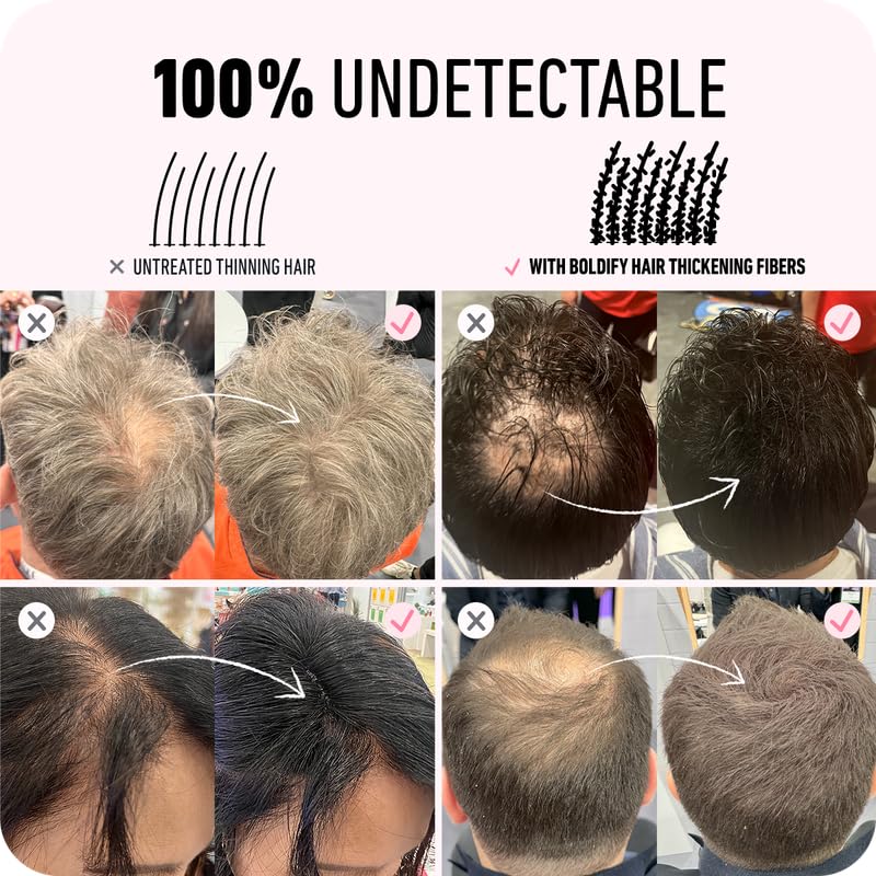 BOLDIFY Hair Fibers (12g) - Fill In Thinning and Fine Hair for an Instantly Fuller, Thicker Look - 14 Shades for Women & Men - White