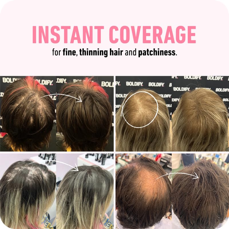 BOLDIFY Hair Fibers (12g) - Fill In Thinning and Fine Hair for an Instantly Fuller, Thicker Look - 14 Shades for Women & Men - White