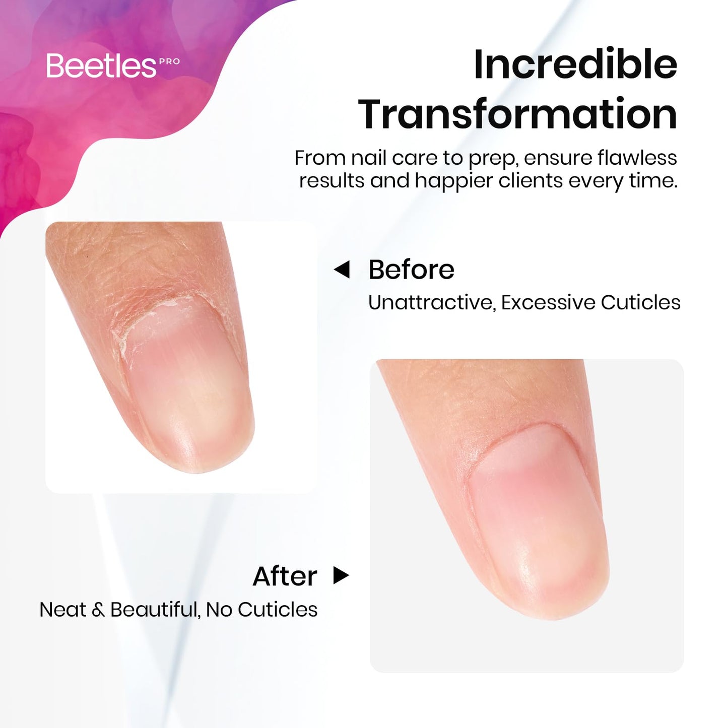 Beetles Pro Cuticle Pusher, Professional Stainless Steel Cuticle Remover Multi-Function Dual Ended Nail Pusher for Fingernail Toenail Nail-Care Salon Manicure Needs