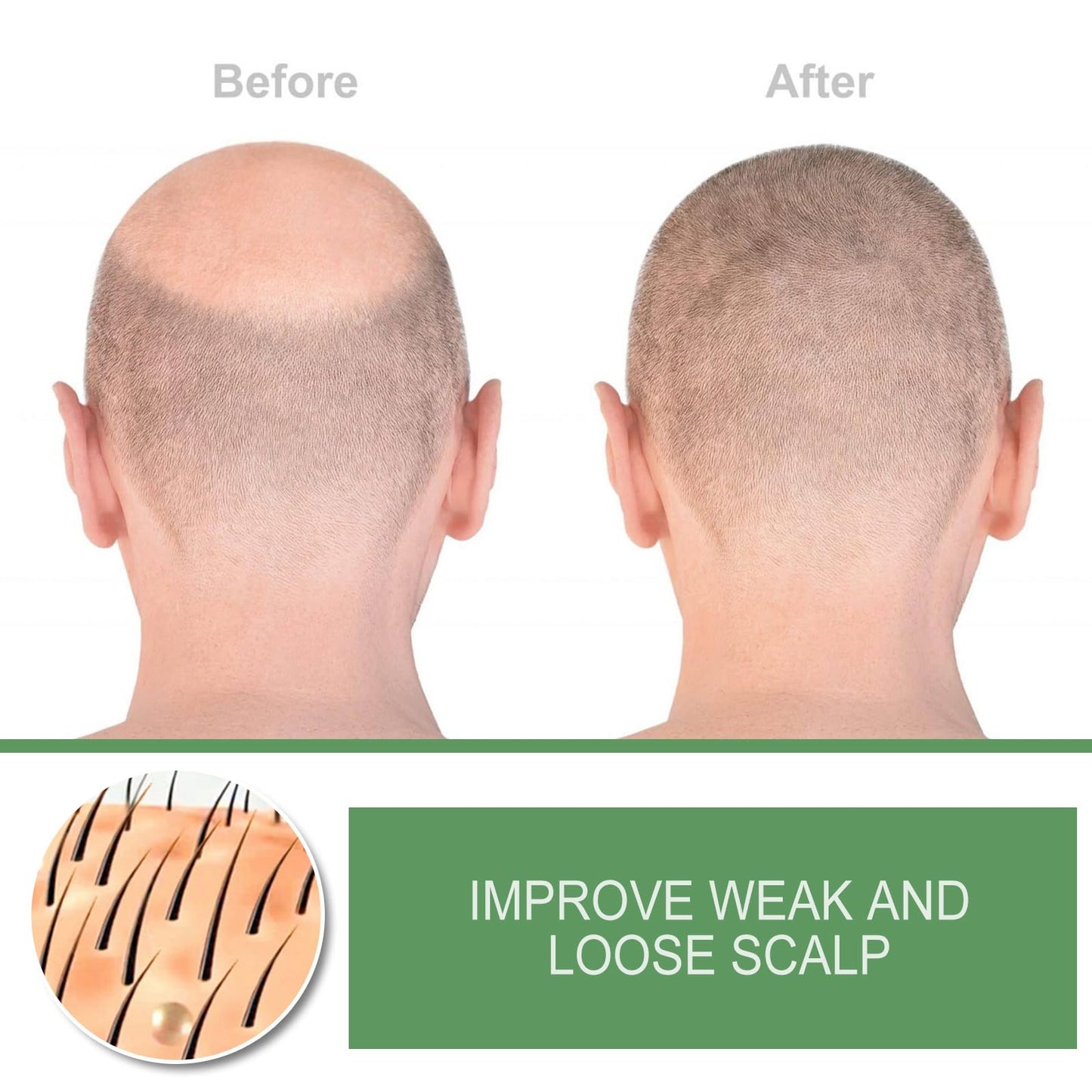 Castor Oil Hair Growth Spray, Enriched with Bio Oil, Olive Oil, and Tea Tree Oil, Promotes Hair Growth and Nourishes Hair (3PCS)