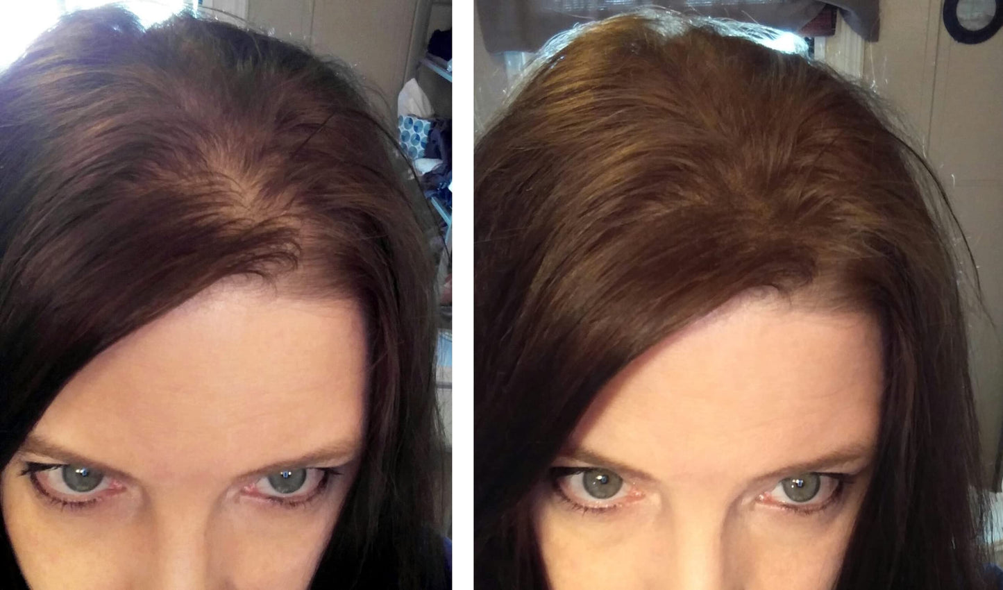 Caboki Hair Loss Concealer (All-Natural Hair Building Fibers) Travel Size (Medium Brown)