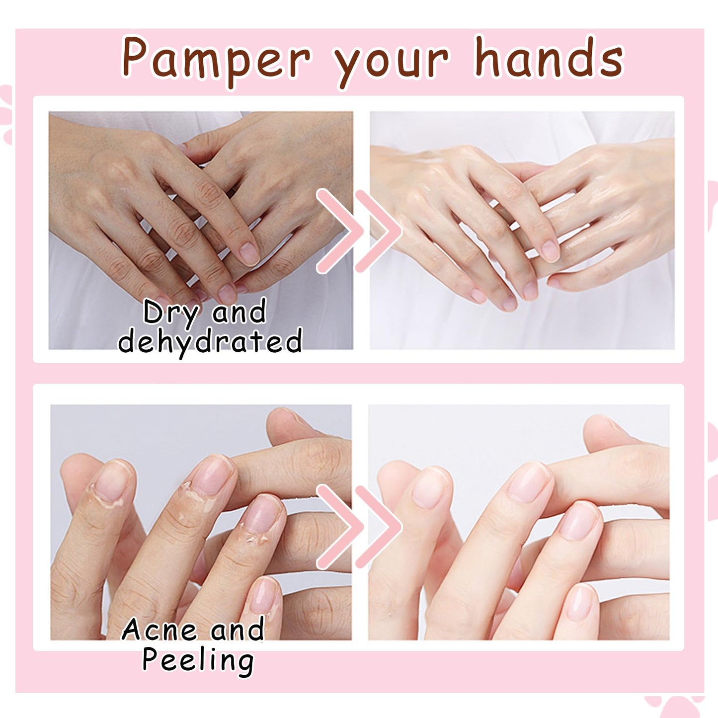 DWDiWen Hand Masks, 6 Pairs Hydrating Exfoliating Hand Peeling Mask, Smooth Hand Masks Moisturizing Gloves Overnight for Dry, Rough, Cracked Hands, Hand Skin Moisturizer Glove for Women Men（N
