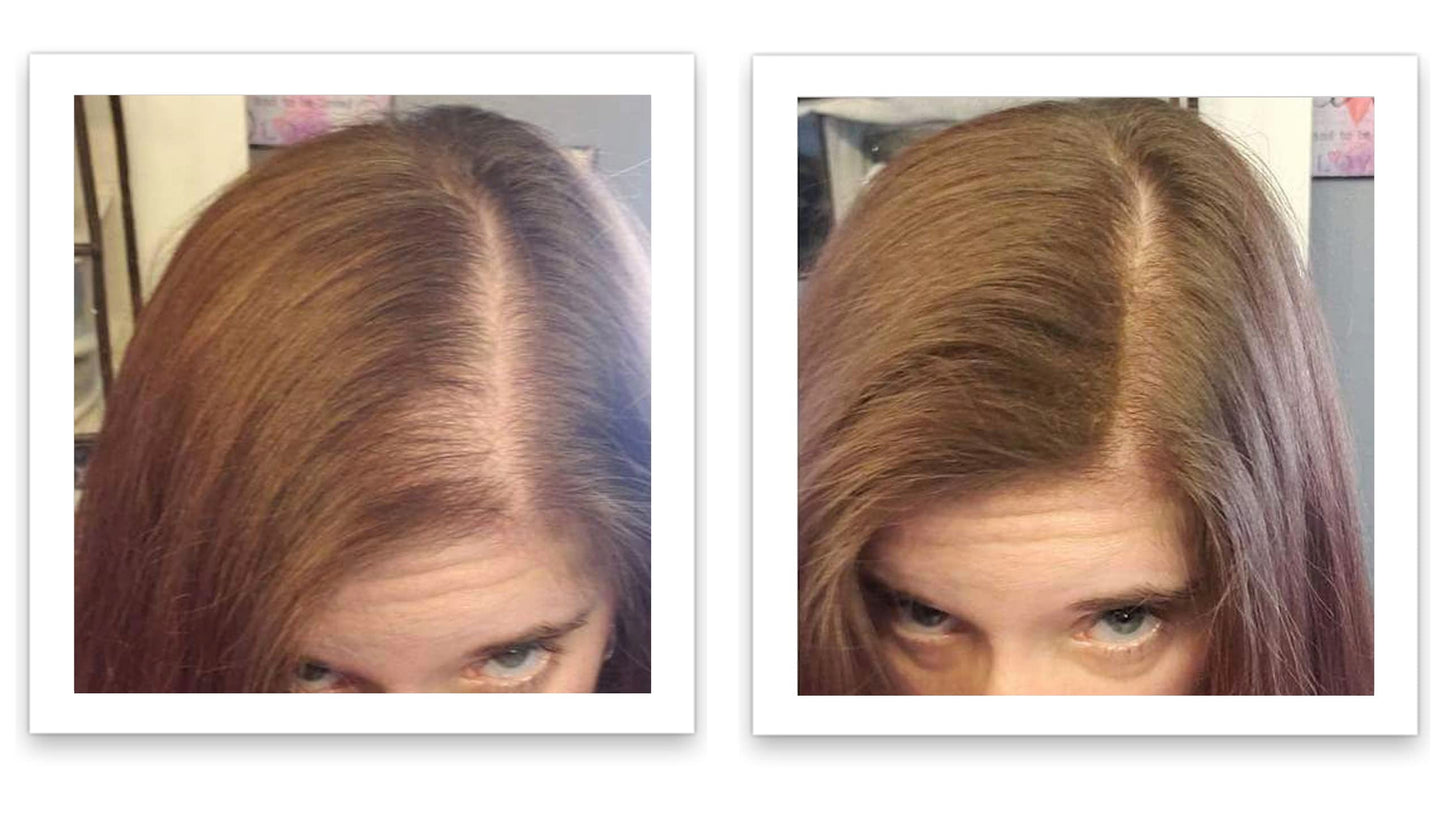 Caboki Hair Loss Concealer (All-Natural Hair Building Fibers) Travel Size (Medium Brown)