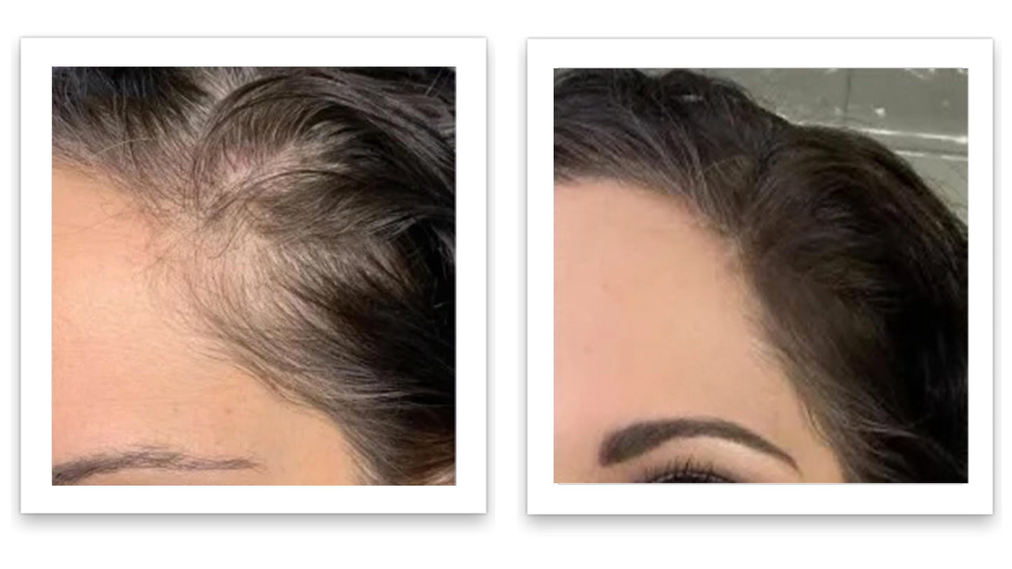 Caboki 10X Hair Powder for Thinning Hair, TALC-Free, Healthful Formula, Instant Fuller Hair, Flawless Roots, Rain and Sweat Resistant, Easy to Use, Natural Blonde, Men and Women