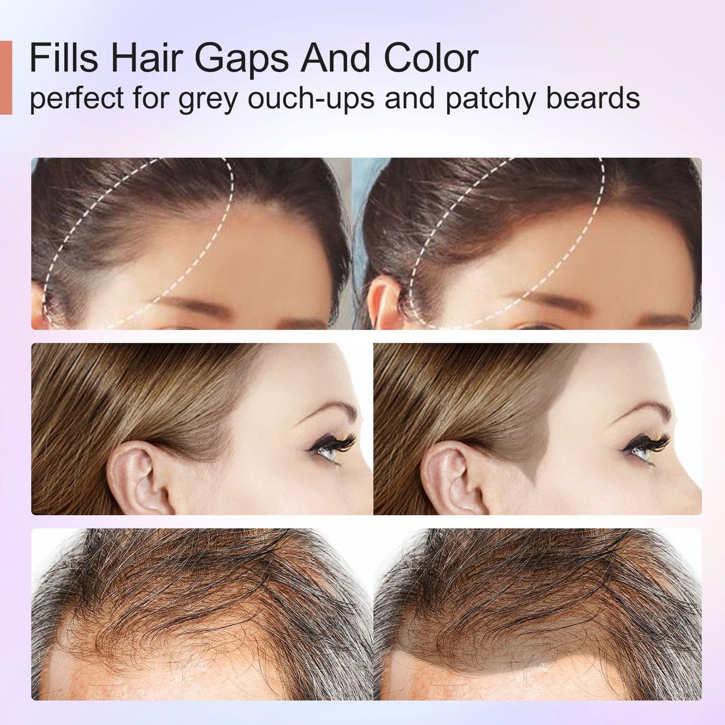 Acomler Instantly Root Touch Up Hairline Shadow Powder,Root Cover Up Hair Powder,Medium Blonde for Thinning Hair, Grey Hair Coverage for Women Men with Eyebrows,Beard Line,Bald Spots (Medium Blonde)
