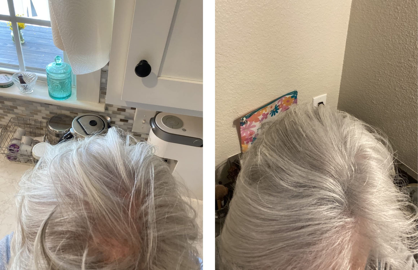 Caboki Hair Loss Concealer. All-Natural Hair Building Fiber. Make Thin Hair Look 10X Fuller Instantly. Eliminate the Appearance of Bald Spot and Thinning Hair (30G, 90-Day Supply). Silver/White